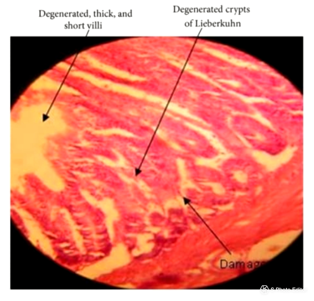 Perubahan histopatologi pada usus ayam broiler penderita RSS (Qamar et al., 2013)